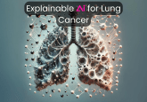 Explainable AI for Lung Cancer