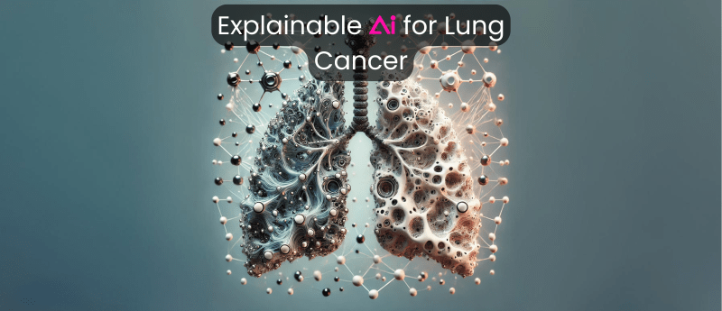 Explainable AI for Lung Cancer